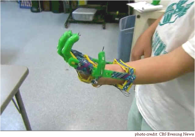 Boy Receives 3 D Prosthetic Hand